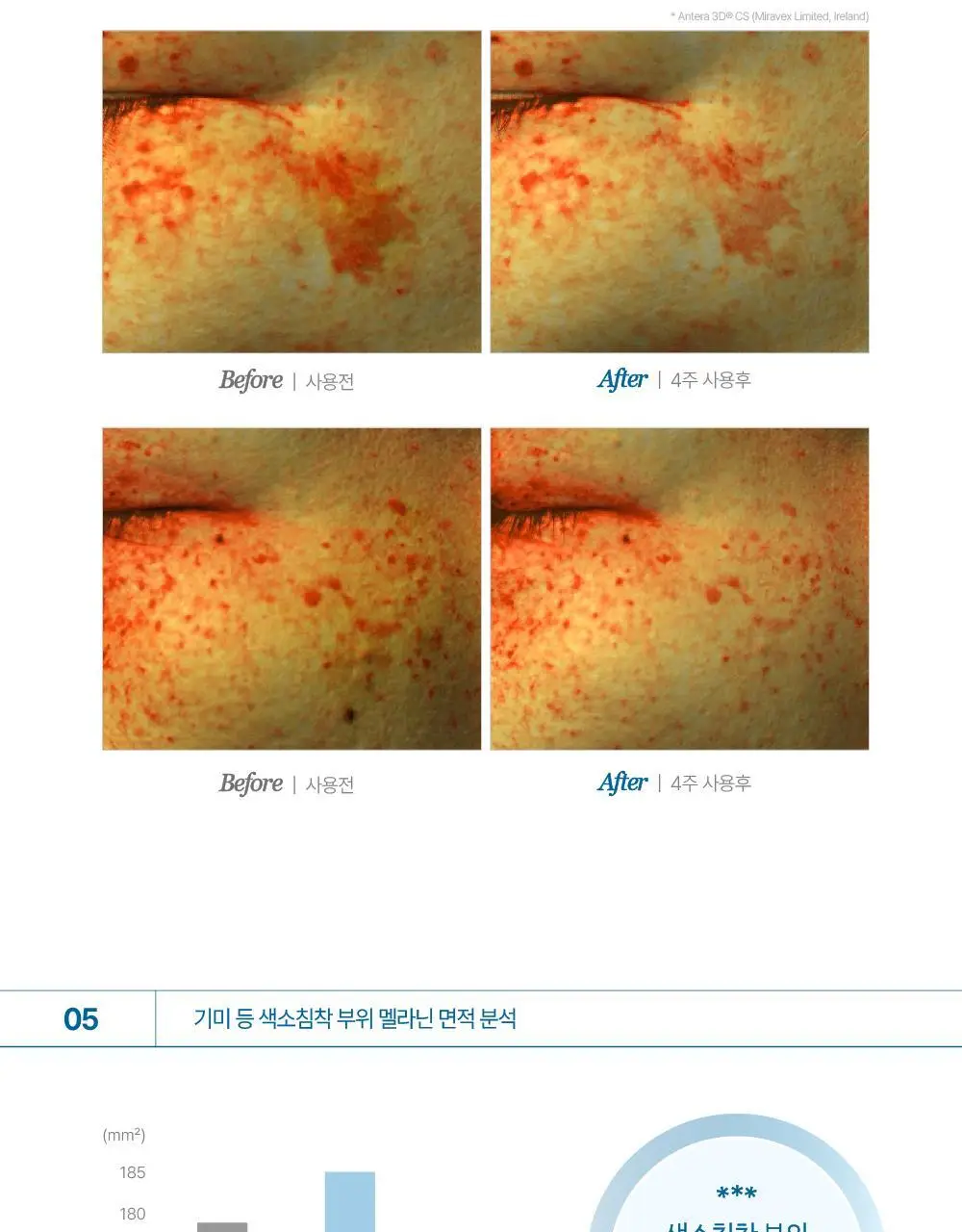 [기미패치] 라보타치 다크스팟 케어 패치 32매 상세페이지 30